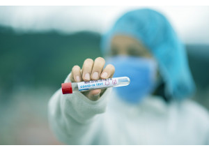 Test de antígenos, ya en farmacias